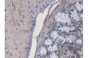 IHC-P analysis of Mouse Colon Tissue, with DAB staining. (Calcitonin Receptor Antikörper  (AA 42-170))
