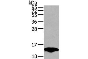 Western Blot analysis of Mouse fat tissue using PMP2 Polyclonal Antibody at dilution of 1/400 (PMP2 Antikörper)