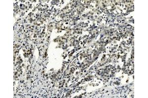 IHC analysis of SMAD2 using anti-SMAD2 antibody (ABIN7602542). (SMAD2 Antikörper  (AA 83-264))