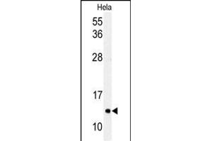 Western blot analysis of G8c (M1LC3C) Antibody (T48) 1804e in Hela cell line lysates (35 μg/lane).