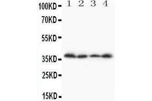 Anti-Stra8 antibody, Western blotting Lane 1: A231 Cell Lysate Lane 2: JURKAT Cell Lysate Lane 3:  Cell Lysate Lane 4: SCG Cell Lysate (STRA8 Antikörper  (C-Term))