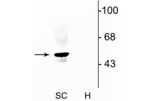 Western blot of rat spinal cord lysate (SC) showing specific immunolabeling of the ~48 kDa α1- and α2-subunits of the glycine receptor. (GLRA1 Antikörper  (N-Term))