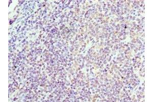 Immunohistochemistry of paraffin-embedded human tonsil tissue using ABIN7153394 at dilution of 1:100 (Cyclin D3 Antikörper  (AA 1-292))