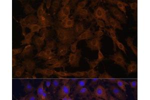 Immunofluorescence analysis of C6 cells using BID Polyclonal Antibody at dilution of 1:100. (BID Antikörper)