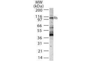 Western Blotting (WB) image for anti-Retinoblastoma Protein (Rb Protein) (AA 251-268) antibody (ABIN233206) (Retinoblastoma Protein (Rb) Antikörper  (AA 251-268))