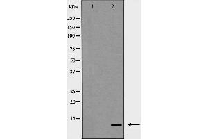 Western blot analysis of S100 A10 expression in COLO cells,The lane on the left is treated with the antigen-specific peptide. (S100A10 Antikörper  (Internal Region))