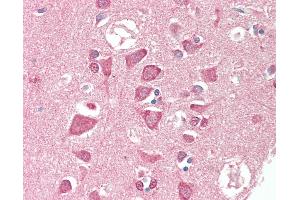 Anti-TSG / TWSG1 antibody IHC staining of human brain, cortex. (TWSG1 Antikörper  (AA 1-223))