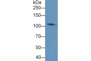 Detection of C5a in Rat Plasma using Polyclonal Antibody to Complement Component 5a (C5a) (C5A Antikörper  (AA 679-755))