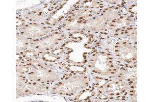 ABIN6267664 at 1/200 staining human kidney tissue sections by IHC-P.