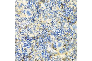 Immunohistochemistry of paraffin-embedded mouse spleen using ICOS antibody (ABIN5970917) at dilution of 1/100 (40x lens). (ICOS Antikörper)