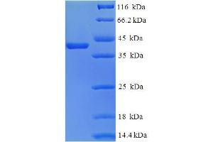 SDS-PAGE (SDS) image for Tescalcin (TESC) (AA 2-214) protein (His-SUMO Tag) (ABIN5710472) (Tescalcin Protein (TESC) (AA 2-214) (His-SUMO Tag))