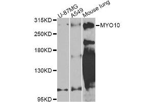 Western blot analysis of extracts of various cell lines, using MYO10 Antibody (ABIN5974593) at 1/1000 dilution. (Myosin X Antikörper)
