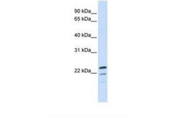 Receptor Accessory Protein 1 Antikörper  (AA 110-159)