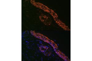 Immunofluorescence (IF) image for anti-Interleukin 1 Receptor Antagonist (IL1RN) antibody (ABIN7267971)