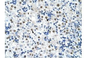 HNRPA0 antibody was used for immunohistochemistry at a concentration of 4-8 ug/ml to stain Hepatocytes (arrows) in Human Liver. (HNRNPA0 Antikörper  (Middle Region))