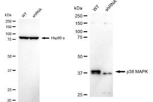 Western blotting analysis using p38 MAPK antibody (ABIN7799448). (Rekombinanter MAPK14 Antikörper)