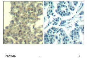 Image no. 1 for anti-Receptor Tyrosine-Protein Kinase ErbB-3 (ERBB3) (AA 1326-1330) antibody (ABIN319384) (ERBB3 Antikörper  (AA 1326-1330))