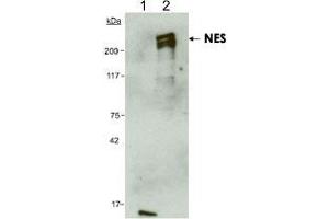 Detection of human NES using NES monoclonal antibody, clone 10C2 . (Nestin Antikörper  (AA 1464-1614))