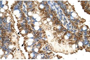 Immunohistochemistry (IHC) image for anti-Phosphoglycerate Kinase 1 (PGK1) (C-Term) antibody (ABIN2783240)