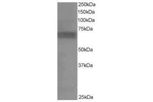 Image no. 1 for anti-Ribosomal Protein S6 Kinase, 70kDa, Polypeptide 1 (RPS6KB1) (C-Term) antibody (ABIN374267) (RPS6KB1 Antikörper  (C-Term))