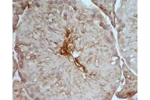 Mouse testis tissue was stained by Rabbit Anti-Desnutrin (465-486) (Mouse) Serum (PNPLA2 Antikörper  (AA 465-486))