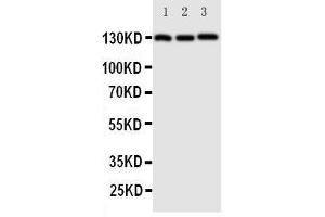 Western Blotting (WB) image for anti-Cadherin 5 (CDH5) (AA 766-784), (C-Term) antibody (ABIN3042913)