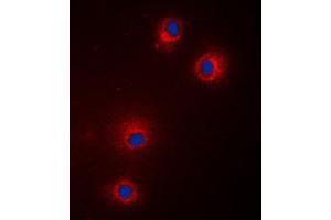 Immunofluorescent analysis of GPR18 staining in Jurkat cells. (GPR18 Antikörper  (Center))