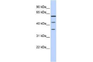 WB Suggested Anti-PHF23 Antibody Titration:  0. (PHF23 Antikörper  (N-Term))