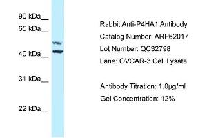 Western Blotting (WB) image for anti-Prolyl 4-Hydroxylase, alpha Polypeptide I (P4HA1) (Middle Region) antibody (ABIN2788990) (P4HA1 Antikörper  (Middle Region))