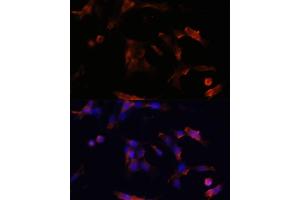 Immunofluorescence analysis of NIH/3T3 cells using  antibody (ABIN6133586, ABIN6137050, ABIN6137052 and ABIN6225252) at dilution of 1:100. (Aquaporin 5 Antikörper  (AA 150-250))