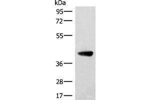 Western blot analysis of Human cerebella tissue lysate using ST8SIA4 Polyclonal Antibody at dilution of 1:350 (ST8SIA4 Antikörper)