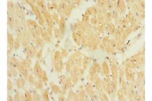 Immunohistochemistry of paraffin-embedded human heart tissue using ABIN7172320 at dilution of 1:100 (TP53TG5 Antikörper  (AA 1-290))