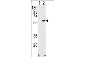 Western blot analysis of STK4 (arrow) using MST1 Antibody (C-term) (ABIN392427 and ABIN2842030).