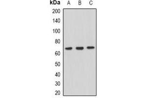 Western blot analysis of XPV expression in Hela (A), HepG2 (B), Raji (C) whole cell lysates. (POLH Antikörper)