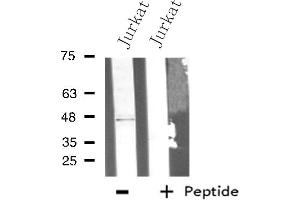 Western blot analysis of extracts from Jurkat cells using PLCH antibody. (AGPAT9 Antikörper  (Internal Region))