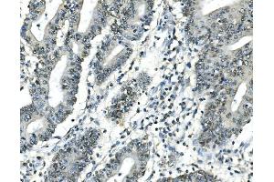 IHC analysis of ATF1 using anti-ATF1 antibody (ABIN7599192). (AFT1 Antikörper  (AA 1-271))