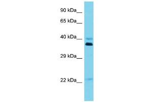 Host: Rabbit Target Name: OR5I1 Sample Type: Jurkat Whole Cell lysates Antibody Dilution: 1. (OR5I1 Antikörper  (C-Term))
