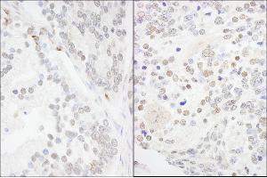 Immunohistochemistry (IHC) image for anti-Ankyrin Repeat and SAM Domain-Containing Protein 3 (ANKS3) (AA 606-656) antibody (ABIN7454745)