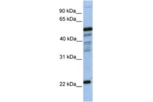Western Blotting (WB) image for anti-Prostaglandin D2 Synthase (PTGDS) antibody (ABIN2463214) (PTGDS Antikörper)