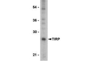 Western blot analysis of TIRP in PC-3 cell lysate with this product at 1 μg/ml.