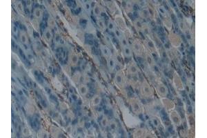 Immunohistochemistry (IHC) image for anti-Lymphotoxin beta Receptor (TNFR Superfamily, Member 3) (LTBR) (AA 128-395) antibody (ABIN7439096)