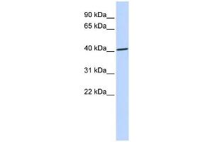 Human 721_B; WB Suggested Anti-ZNF696 Antibody Titration: 0. (ZNF696 Antikörper  (N-Term))