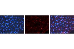Rabbit Anti-CEBPD Antibody   Formalin Fixed Paraffin Embedded Tissue: Human Liver Tissue Observed Staining: Nucleus Primary Antibody Concentration: 1:100 Other Working Concentrations: N/A Secondary Antibody: Donkey anti-Rabbit-Cy3 Secondary Antibody Concentration: 1:200 Magnification: 20X Exposure Time: 0.