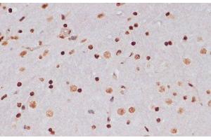 Immunohistochemistry (Paraffin-embedded Sections) (IHC (p)) image for anti-Histone H3 (H3) (acLys14), (acLys18), (acLys23), (acLys27), (acLys9) antibody (ABIN7259751)