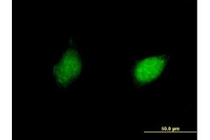 Immunofluorescence of purified MaxPab antibody to RXRG on HeLa cell. (Retinoid X Receptor gamma Antikörper  (AA 1-463))