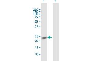 Western Blot analysis of GUK1 expression in transfected 293T cell line by GUK1 MaxPab polyclonal antibody. (GUK1 Antikörper  (AA 1-197))