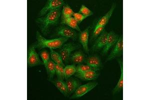 IF analysis of SUGT1 using anti-SUGT1 antibody (ABIN7600820) and anti-Tubulin Alpha antibody (ABIN7600339).