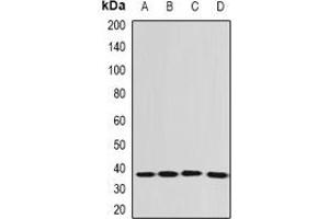 Western Blotting (WB) image for anti-Eukaryotic Translation Elongation Factor 1 delta (Guanine Nucleotide Exchange Protein) (EEF1D) antibody (ABIN7307748)