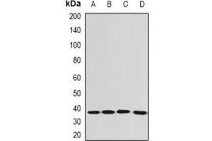 Western blot analysis of EEF1D expression in SHSY5Y (A), Jurkat (B), A549 (C), mouse spleen (D) whole cell lysates. (EEF1D Antikörper)