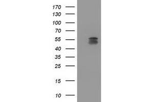 Western Blotting (WB) image for anti-Cytochrome P450, Family 2, Subfamily C, Polypeptide 9 (CYP2C9) antibody (ABIN1497726) (CYP2C9 Antikörper)